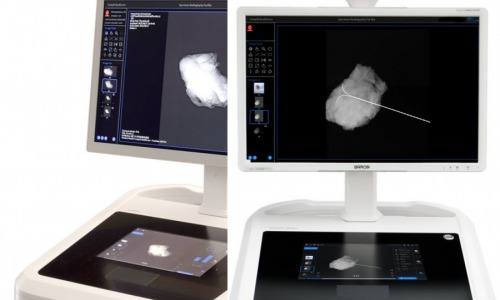 system radiografii bioptatów biopsyjnych