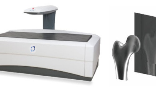 Densytometry