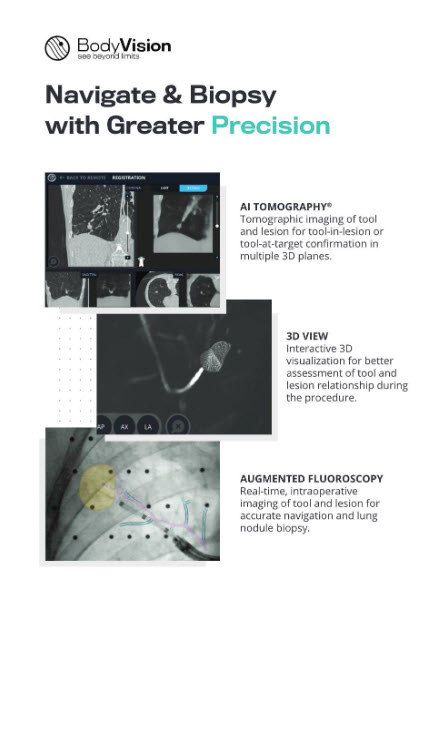 Broszura BodyVision